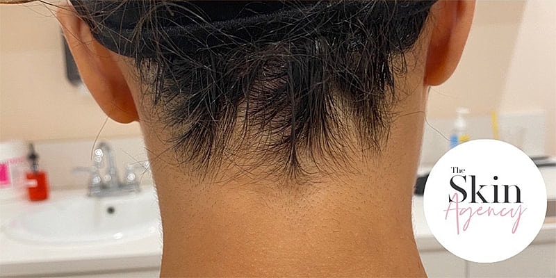 Close-up of hair at nape of neck.