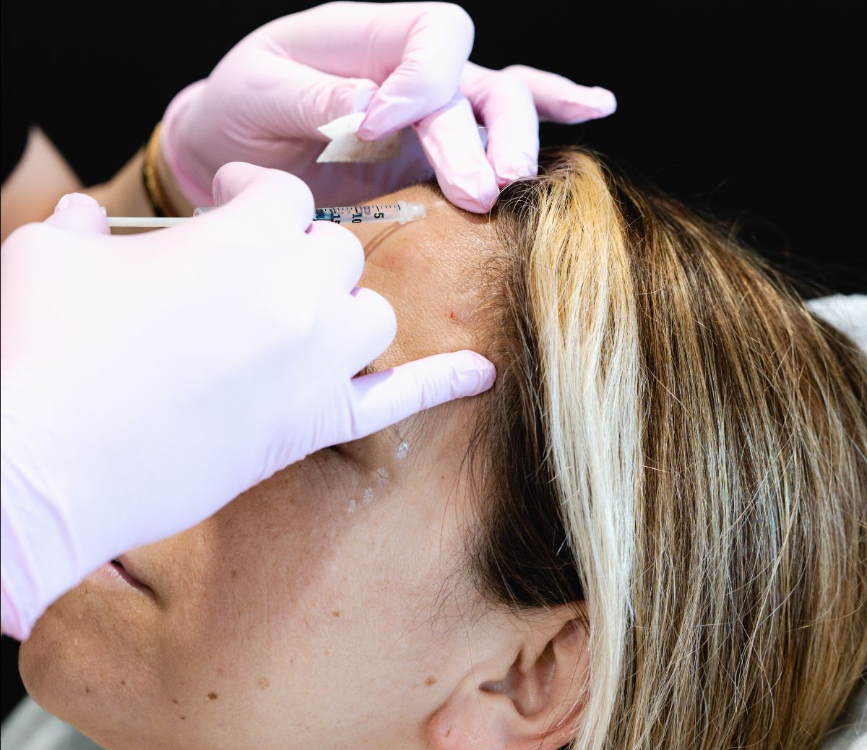 Toluca Lake med spa model with black hair