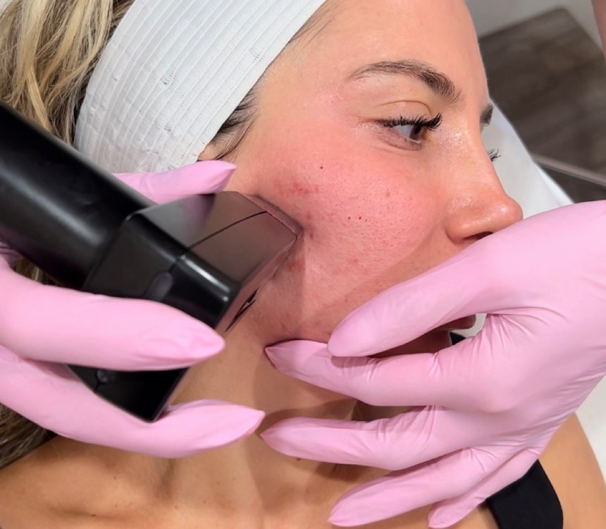 Toluca Lake med spa model with black hair