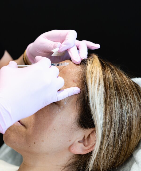 botox burbank