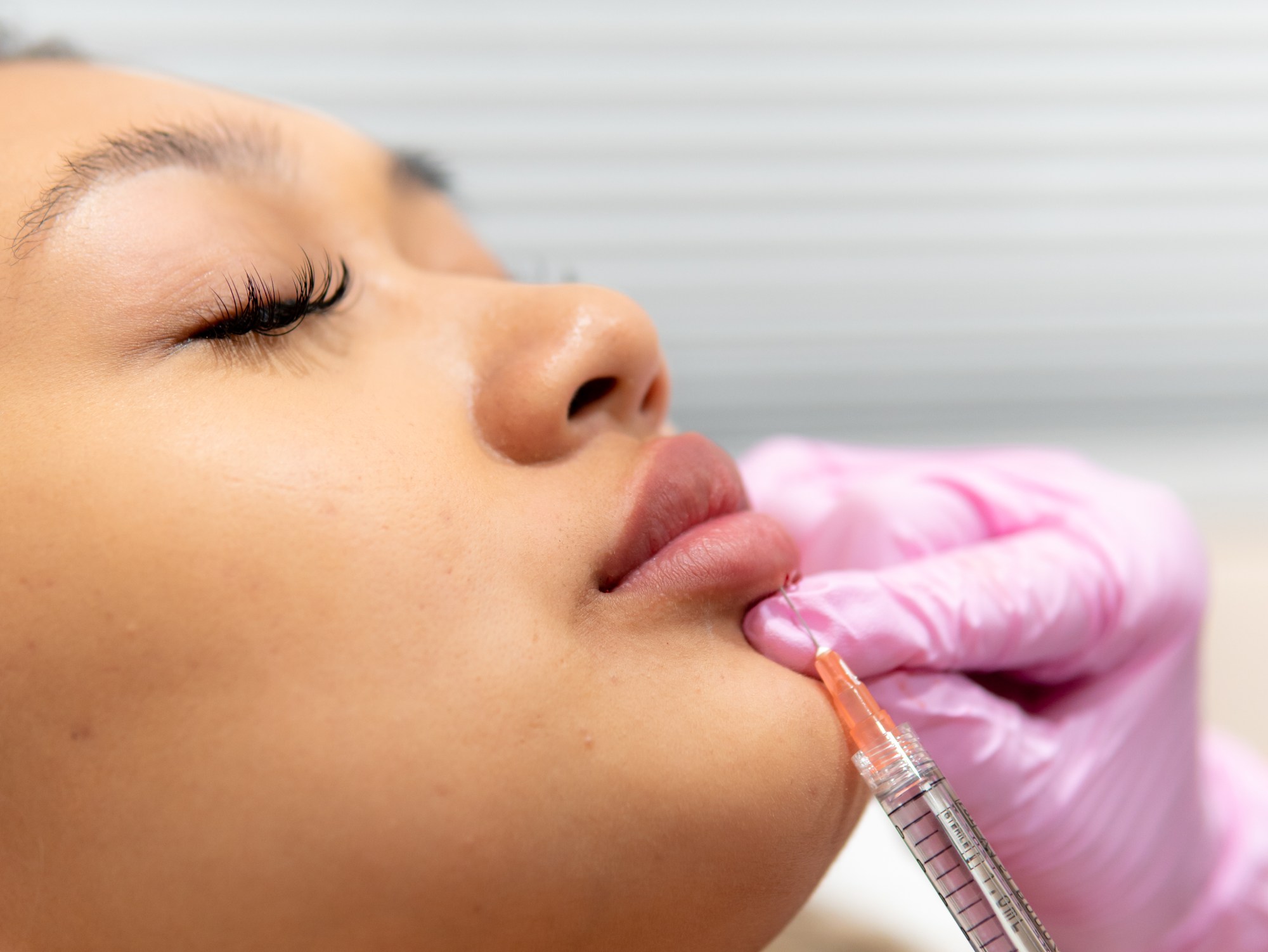 Med Spa Burbank Med Spa Glendale The Skin Agency